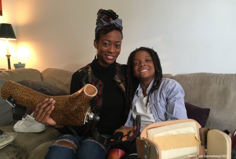 10-year-old Reaches Out To Prosthetic Users Around The World by Repurposing Used Artificial Limbs